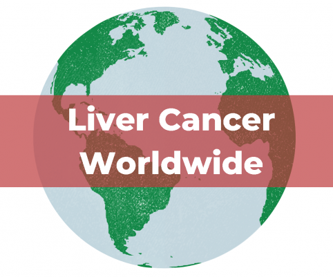 Liver cancer worldwide