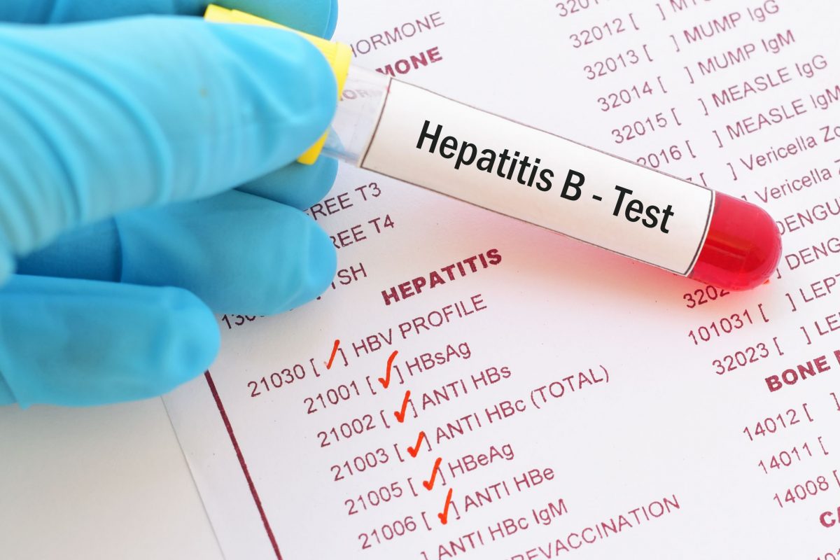 case study of patient with hepatitis b